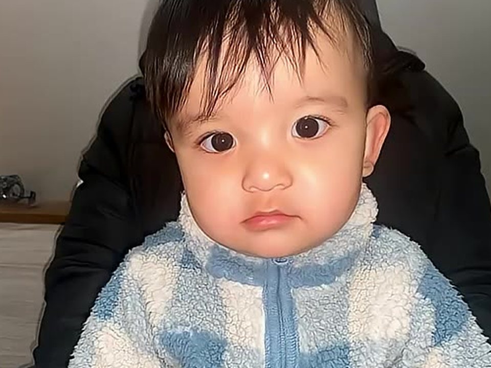 A baby with a wide nasal bridge whose eyes look slightly turned in but are straight