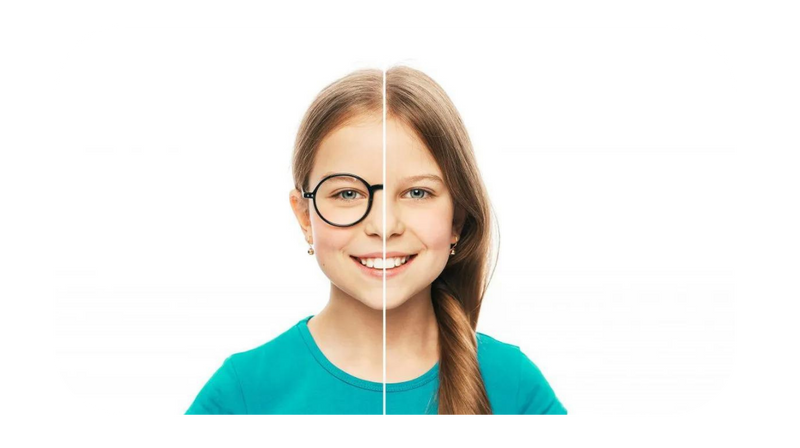 Orthokeratology contact lenses at Optiplex